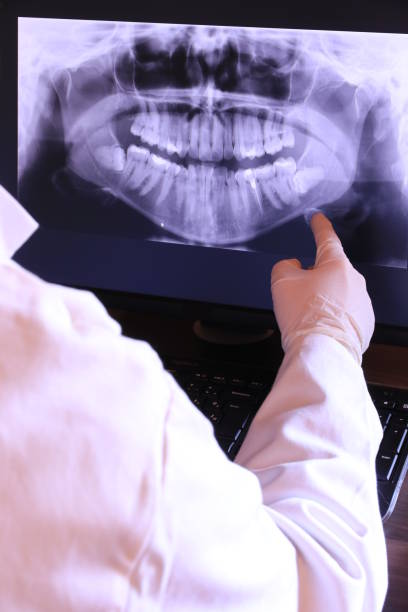 Best Knocked-Out Tooth (Avulsed Tooth) Treatment in Pace, FL